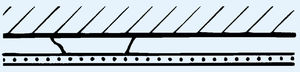 acoustic plasterboard 1
